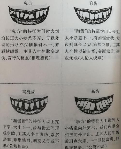 露上下齿面相(齿露)