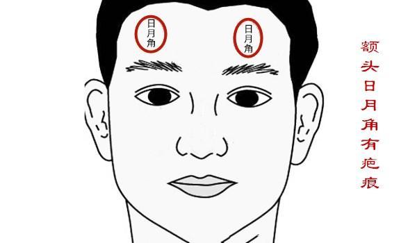 曰月角面相 日角月角