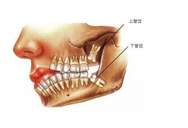 长四颗智齿的人运势(长四颗智齿的人命运)